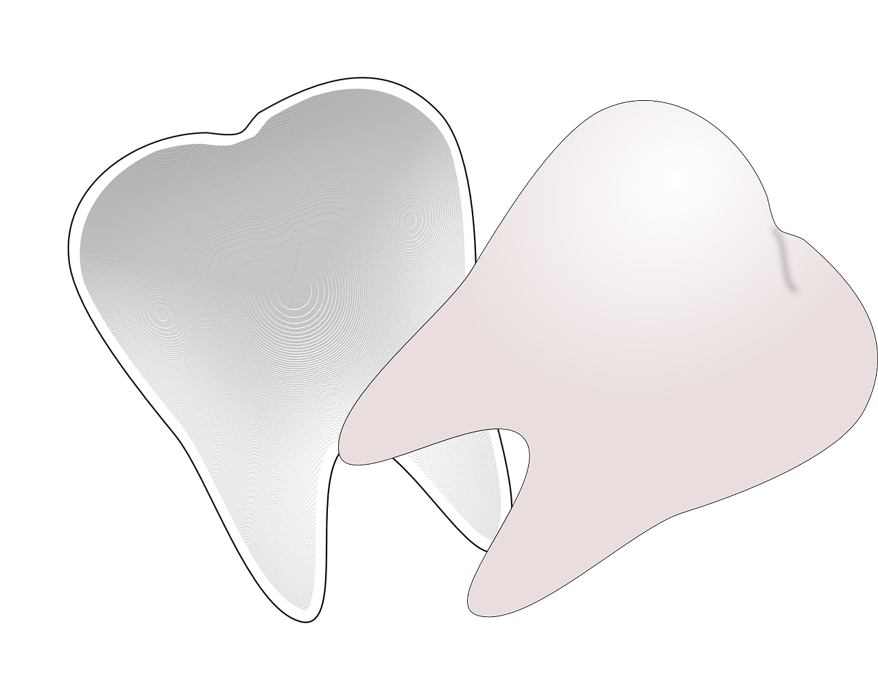 implant dentar in sectorul 3